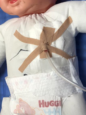 胸腔闭式引流-表单-金数据