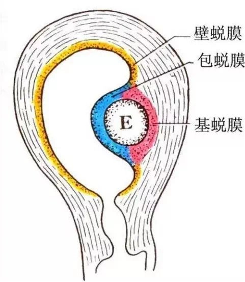 图3  早孕示意图e代表孕囊,其它为蜕膜组织问医生,药流不干净一定要